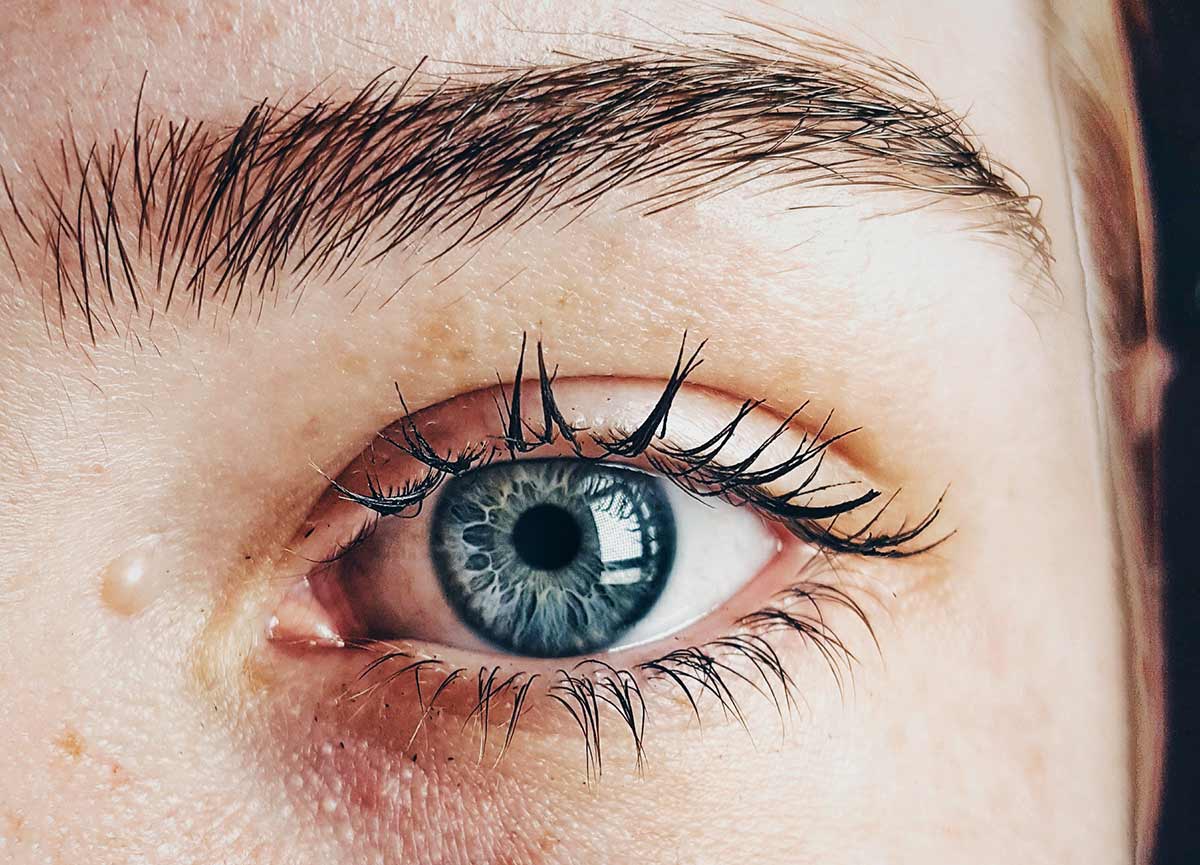 Derrames oculares: ¡por qué suceden y cómo tratarlos?