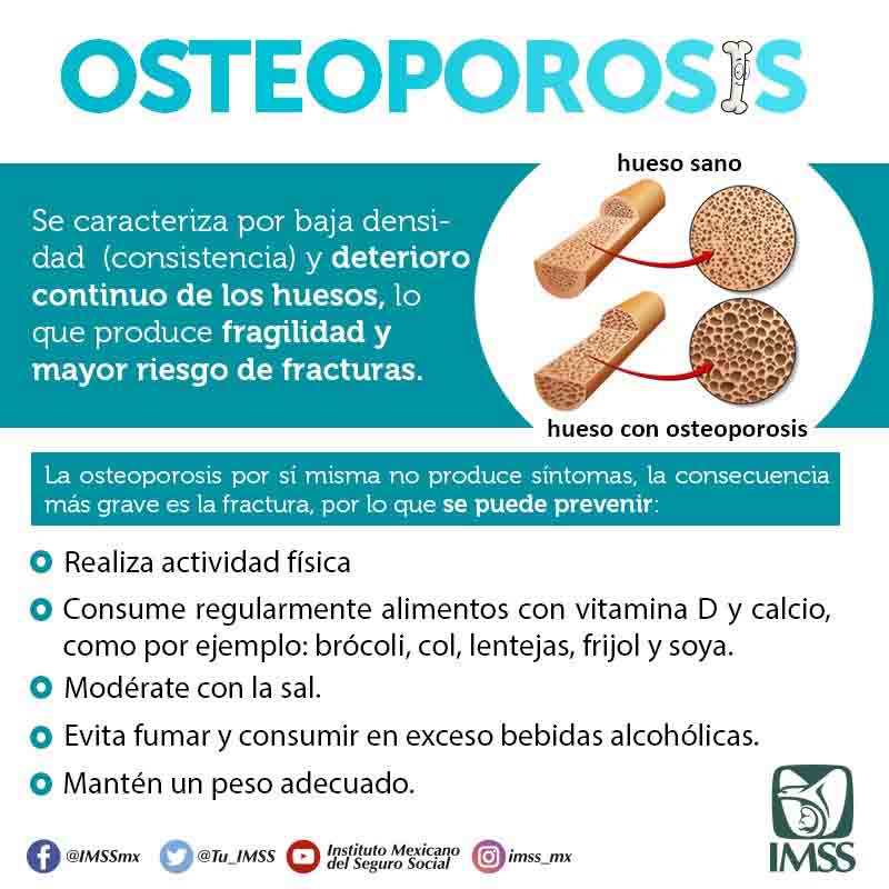 Alimentos que previenen la osteoporosis