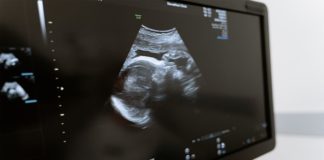 Ultrasonido para mujer embarazada